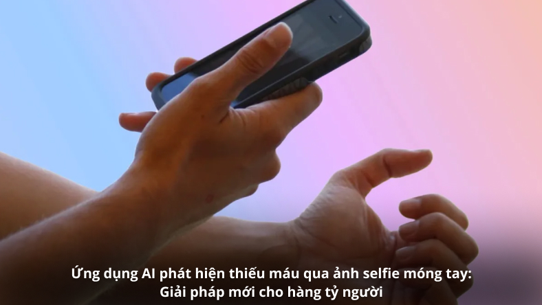 Ứng dụng AI phát hiện thiếu máu qua ảnh selfie móng tay: Giải pháp mới cho hàng tỷ người